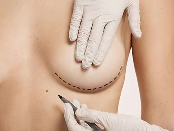 Cirurgia de Prótese de Silicone e Redução de Mamas Santa Maria RS